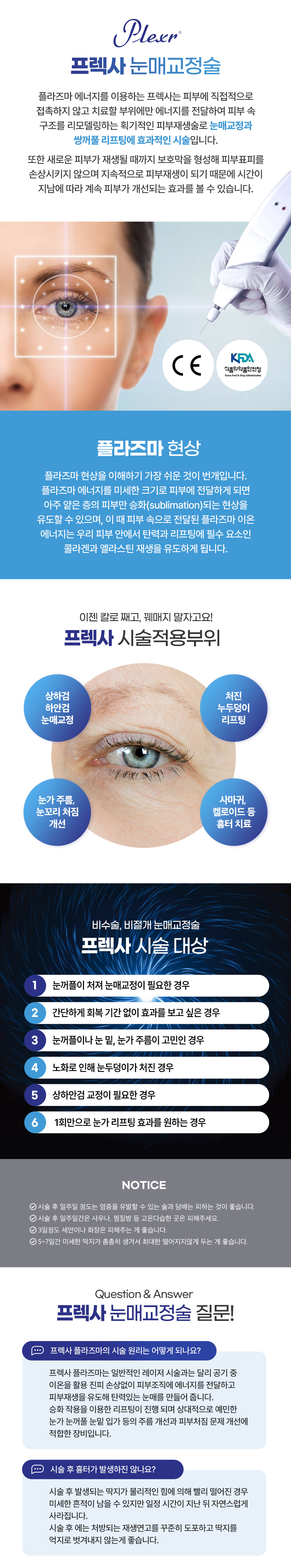 프렉사 눈매교정술